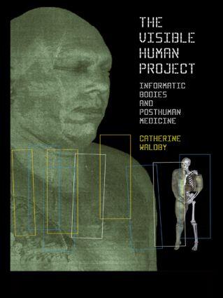 The Visible Human Project