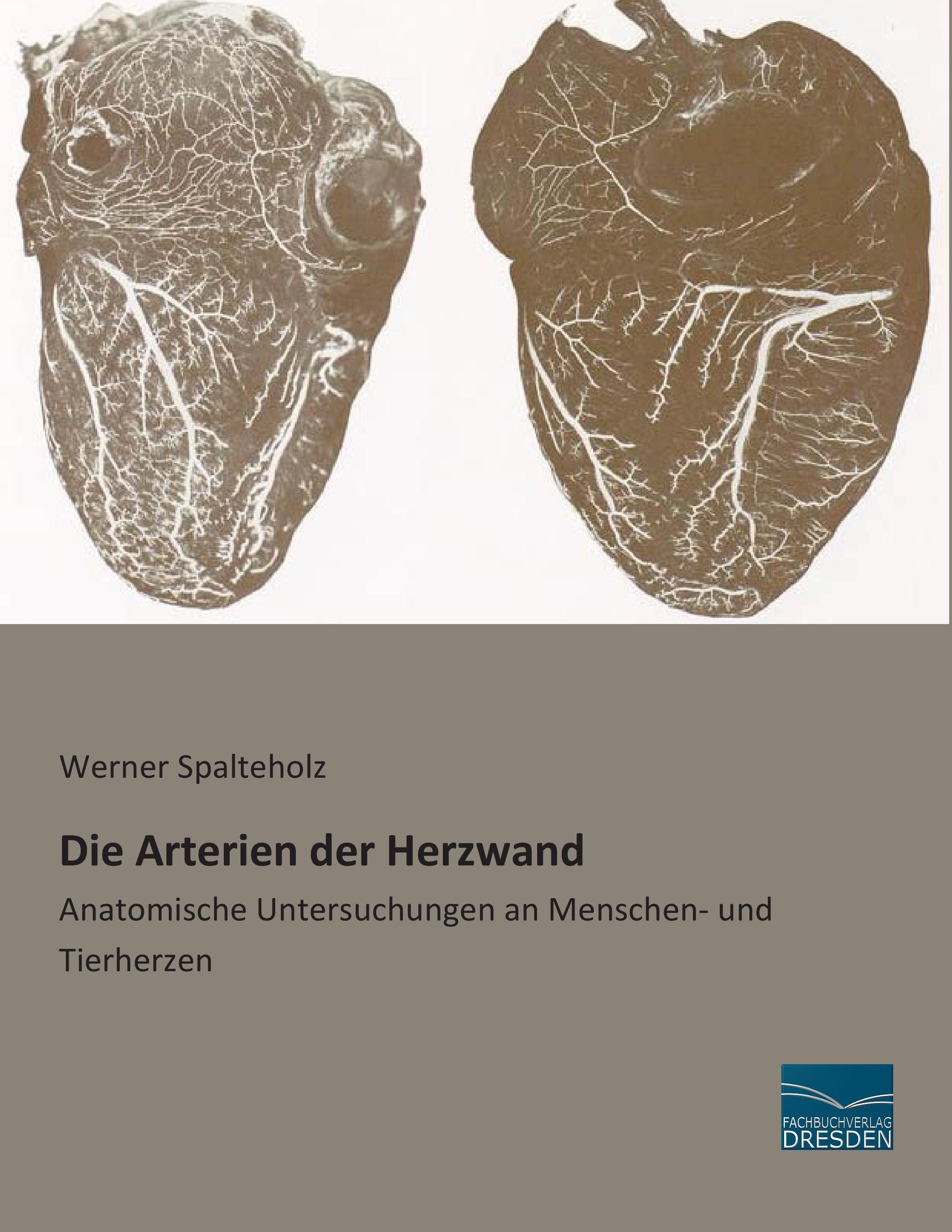 Die Arterien der Herzwand