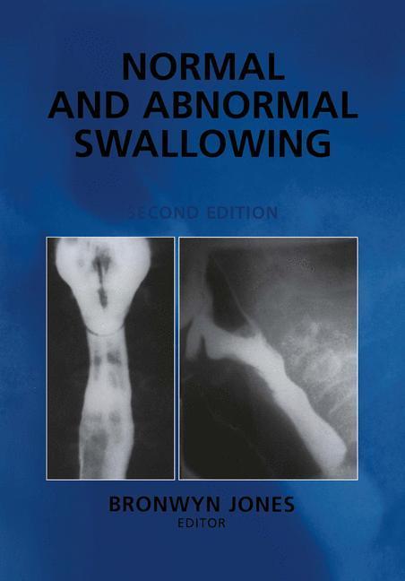 Normal and Abnormal Swallowing