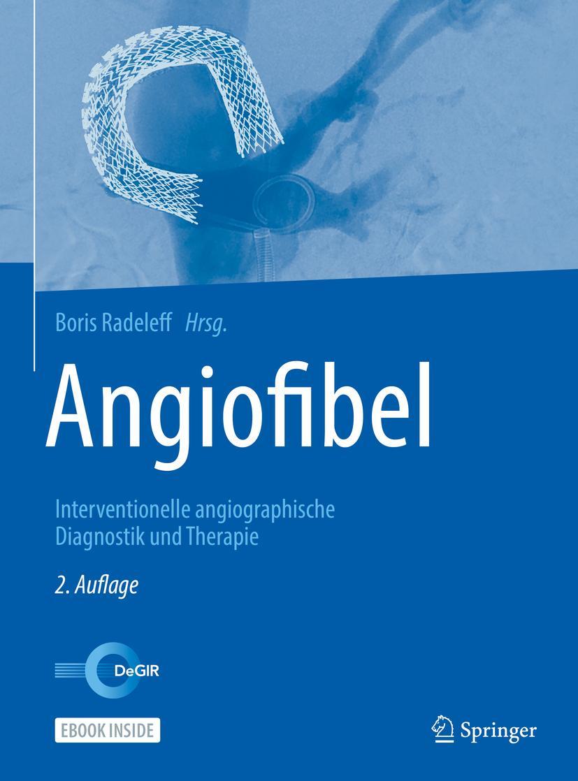 Angiofibel