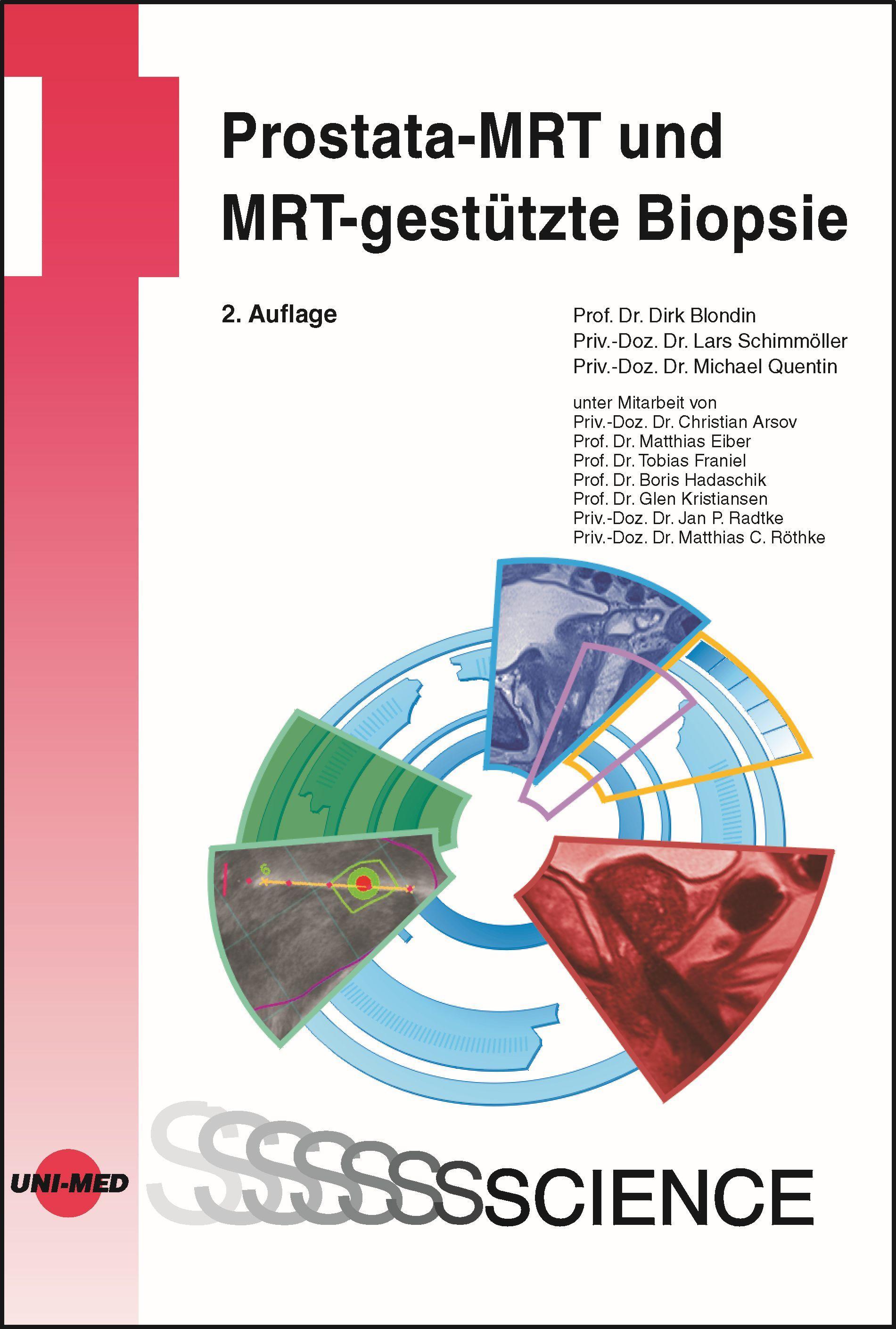 Prostata-MRT und MRT-gestützte Biopsie