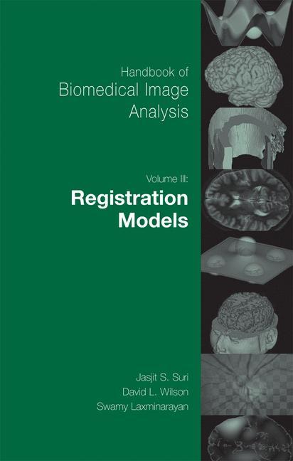 Handbook of Biomedical Image Analysis