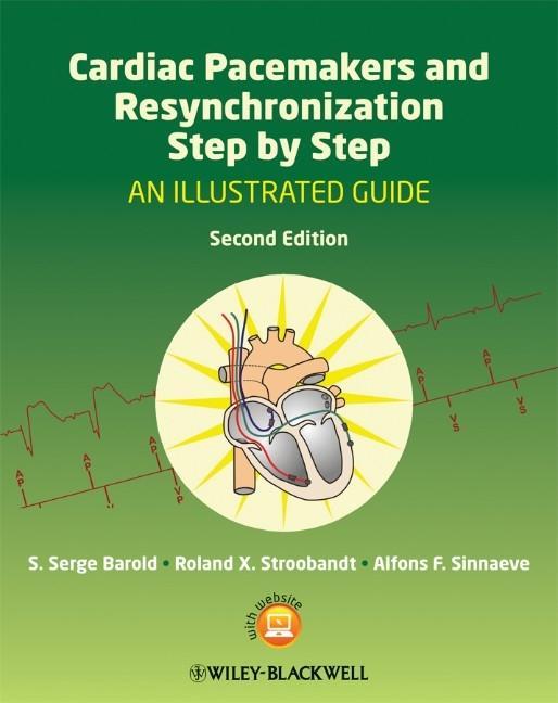 Cardiac Pacemakers and Resynchronization Therapy Step-by-Step