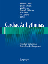 Cardiac Arrhythmias