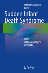 Sudden Infant Death Syndrome