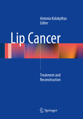 Lip Cancer