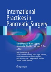 International Practices in Pancreatic Surgery