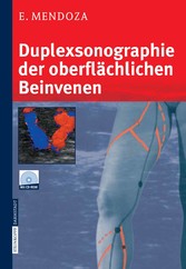 Duplexsonographie der oberflächlichen Beinvenen