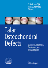 Talar Osteochondral Defects