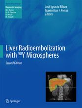 Liver Radioembolization with 90Y Microspheres