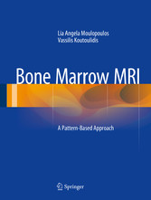 Bone Marrow MRI