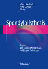 Spondylolisthesis