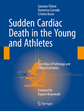 Sudden Cardiac Death in the Young and Athletes