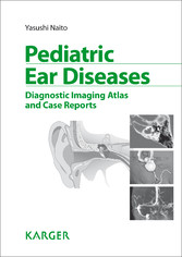 Pediatric Ear Diseases