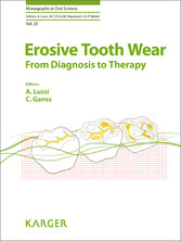 Erosive Tooth Wear