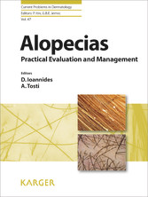 Alopecias - Practical Evaluation and Management