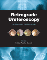 Retrograde Ureteroscopy