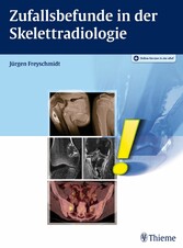 Zufallsbefunde in der Skelettradiologie