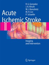 Acute Ischemic Stroke