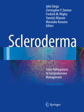 Scleroderma