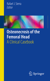 Osteonecrosis of the Femoral Head