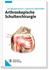 Arthroskopische Schulterchirurgie