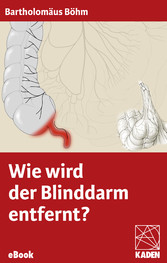 Wie wird der Blinddarm entfernt?