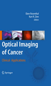 Optical Imaging of Cancer