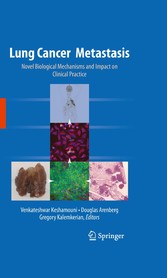 Lung Cancer Metastasis