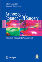 Arthroscopic Rotator Cuff Surgery