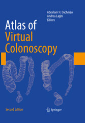 Atlas of Virtual Colonoscopy