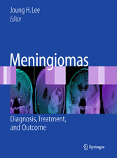 Meningiomas