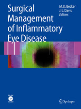 Surgical Management of Inflammatory Eye Disease