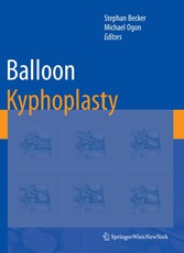 Balloon Kyphoplasty