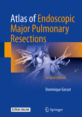 Atlas of Endoscopic Major Pulmonary Resections