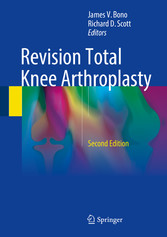 Revision Total Knee Arthroplasty