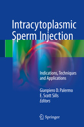 Intracytoplasmic Sperm Injection