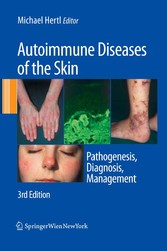 Autoimmune Diseases of the Skin