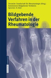 Bildgebende Verfahren in der Rheumatologie