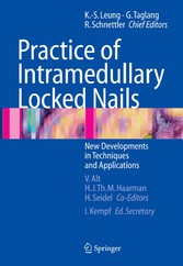 Practice of Intramedullary Locked Nails