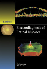 Electrodiagnosis of Retinal Disease