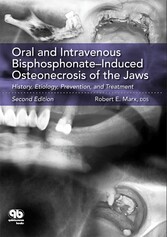 Oral and Intravenous Bisphosphonate-Induced Osteonecrosis of the Jaws