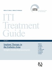 Implant Therapy in the Esthetic Zone