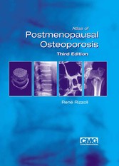 Atlas of Postmenopausal Osteoporosis