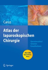 Operationsatlas Laparoskopische Chirurgie