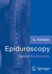 Epiduroscopy