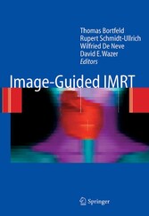 Image-Guided IMRT