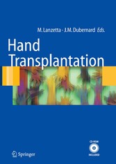 Hand transplantation