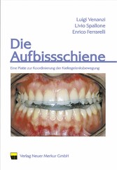 Die Aufbissschiene