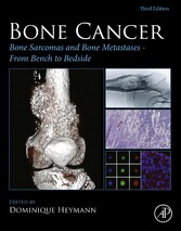 Bone Cancer